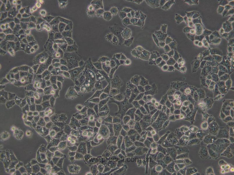 C-33 A (人子宮頸癌細(xì)胞) (STR鑒定正確)