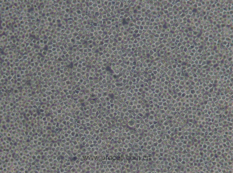 CA46 (人Burkitt's淋巴瘤細胞) (STR鑒定正確)