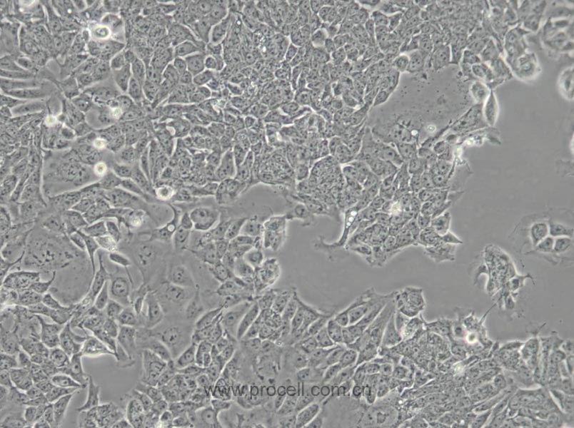 HCT-15 (人結(jié)直腸腺癌細(xì)胞) (STR鑒定正確)