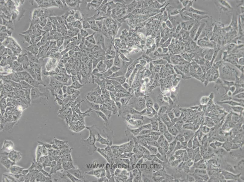 HCT-15 (人結(jié)直腸腺癌細(xì)胞) (STR鑒定正確)