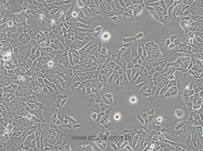 HCT-15 (人結(jié)直腸腺癌細(xì)胞) (STR鑒定正確)