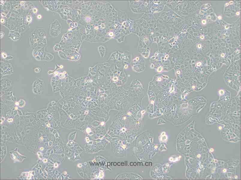 HEC-1-A (人子宮內(nèi)膜腺癌細胞) (STR鑒定正確)