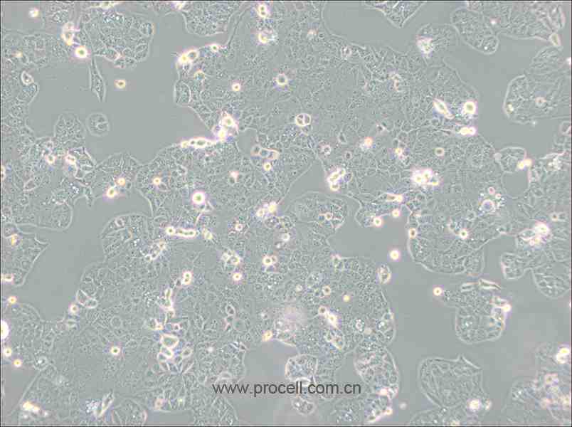 HEC-1-A (人子宮內(nèi)膜腺癌細胞) (STR鑒定正確)