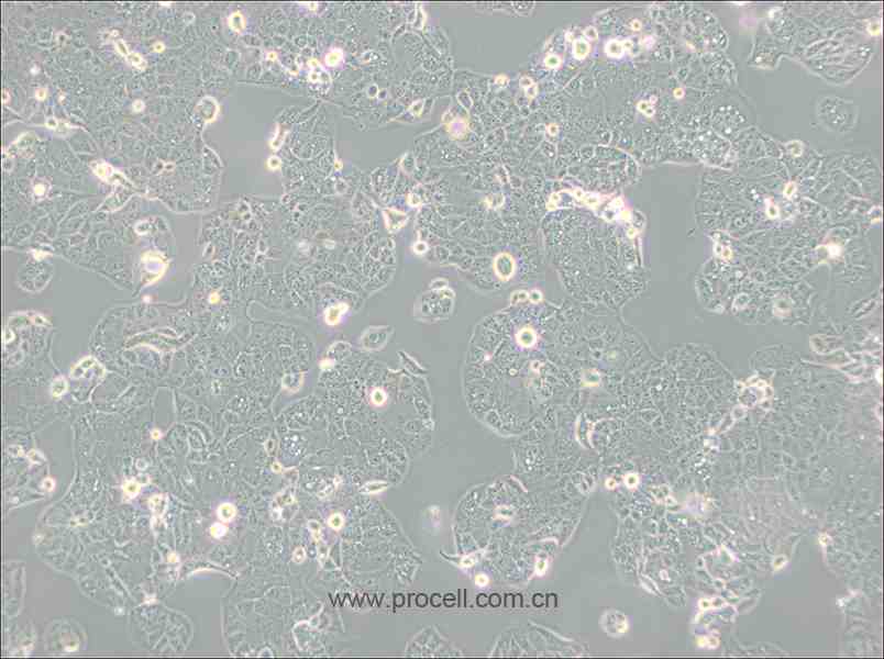 HEC-1-A (人子宮內(nèi)膜腺癌細胞) (STR鑒定正確)