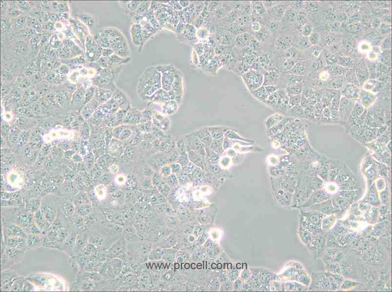 HEC-1-A (人子宮內(nèi)膜腺癌細胞) (STR鑒定正確)