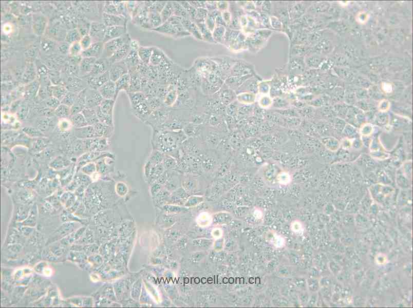 HEC-1-A (人子宮內(nèi)膜腺癌細胞) (STR鑒定正確)