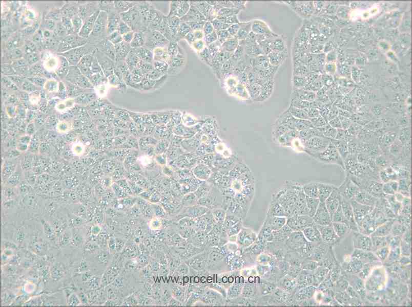 HEC-1-A (人子宮內(nèi)膜腺癌細胞) (STR鑒定正確)