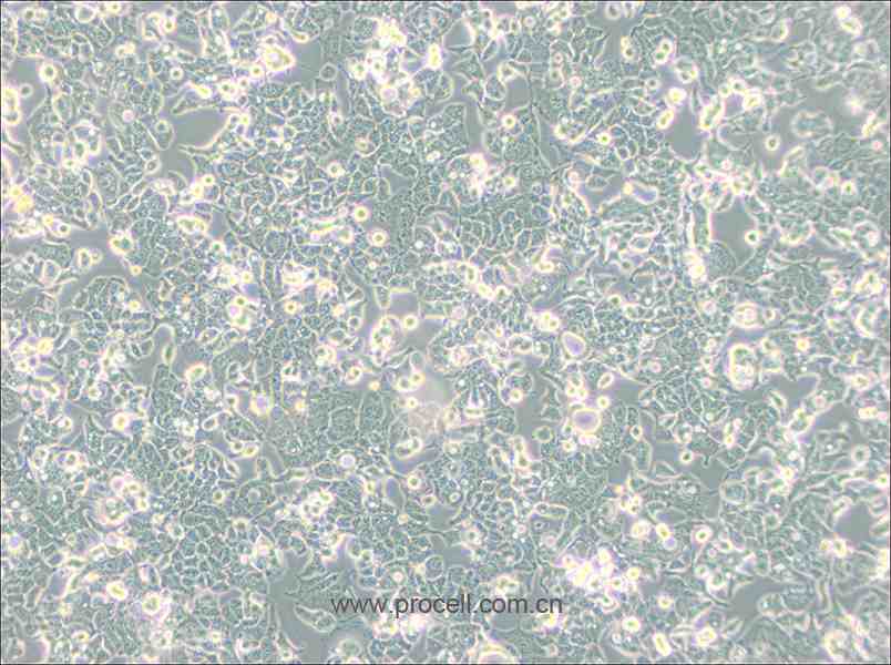 HEC-1-B (人子宮內膜腺癌細胞) (STR鑒定正確)