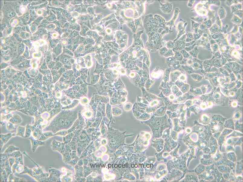 HEC-1-B (人子宮內膜腺癌細胞) (STR鑒定正確)