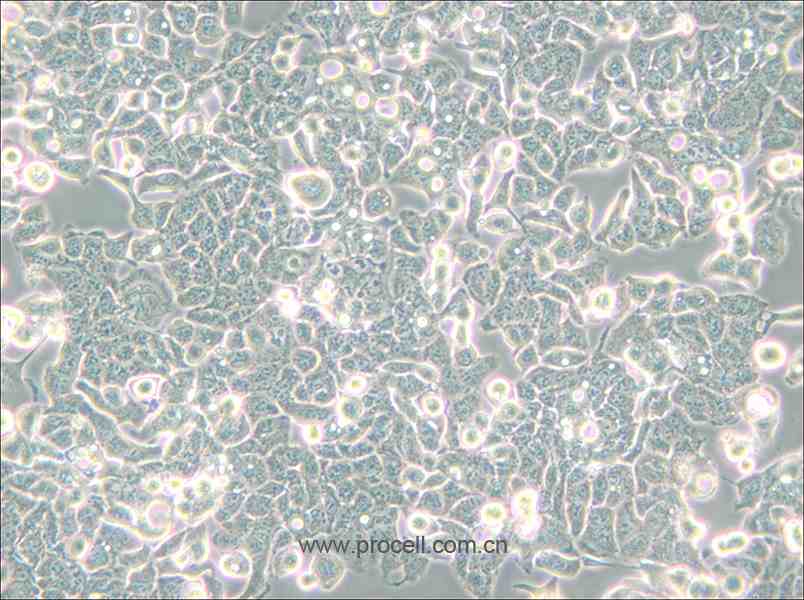 HEC-1-B (人子宮內膜腺癌細胞) (STR鑒定正確)