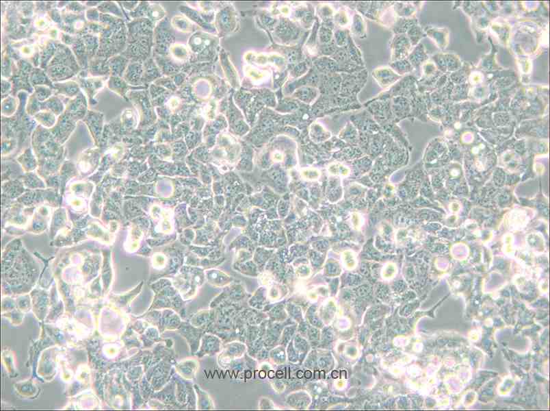 HEC-1-B (人子宮內膜腺癌細胞) (STR鑒定正確)