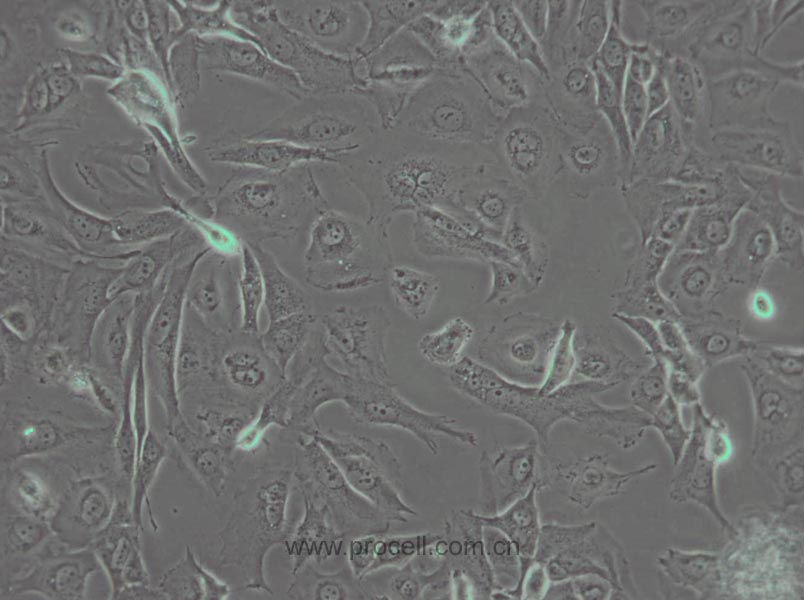 J82 (人膀胱移行細胞癌) (STR鑒定正確)