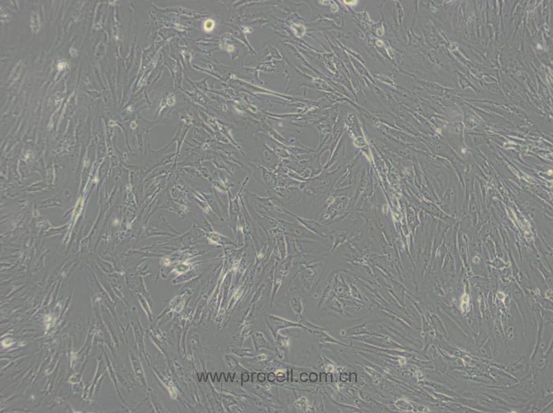 MRC-5 (人胚肺細(xì)胞) (STR鑒定正確)