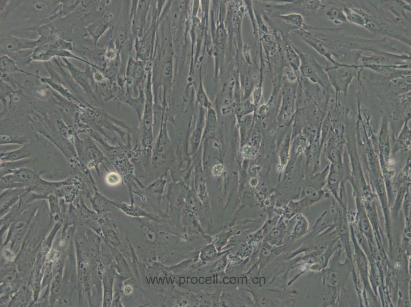 MRC-5 (人胚肺細(xì)胞) (STR鑒定正確)