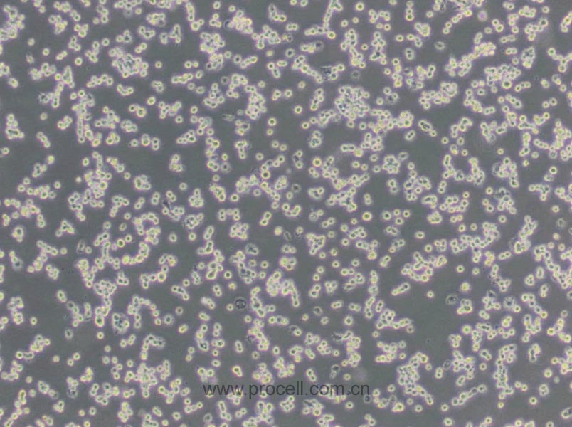 NR8383 [AgC11x3A; NR8383.1] (大鼠肺泡巨噬細(xì)胞) (種屬鑒定正確)