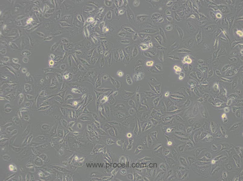 OS-RC-2 (人腎癌細胞) (STR鑒定正確)