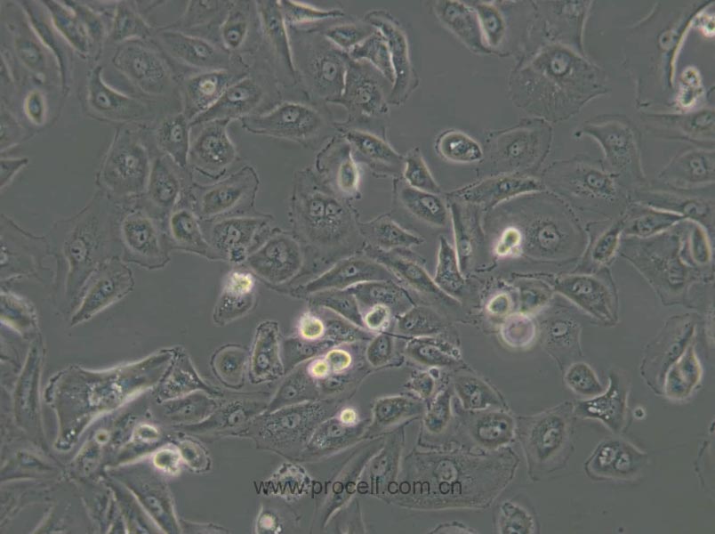 OS-RC-2 (人腎癌細胞) (STR鑒定正確)