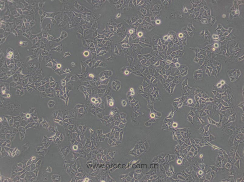 PANC-1 (人胰腺癌細(xì)胞) (STR鑒定正確)