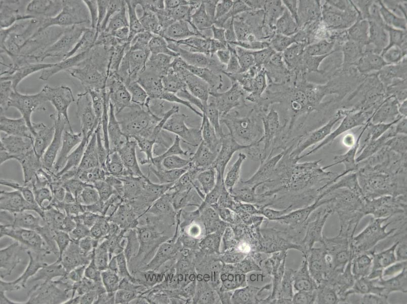 SW579 [SW 579; SW-579] (人甲狀腺鱗癌細(xì)胞) (STR鑒定正確)