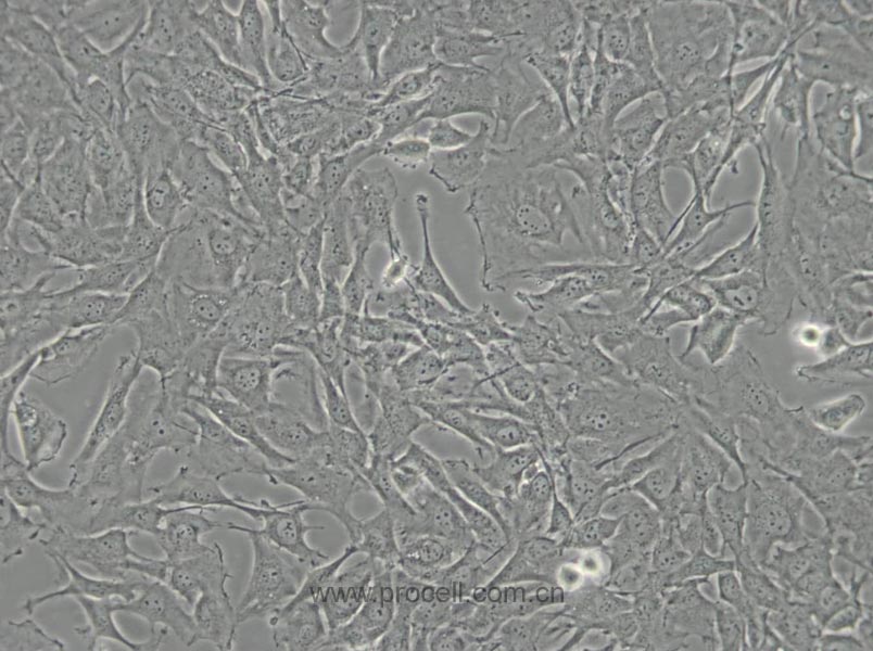 SW579 [SW 579; SW-579] (人甲狀腺鱗癌細(xì)胞) (STR鑒定正確)