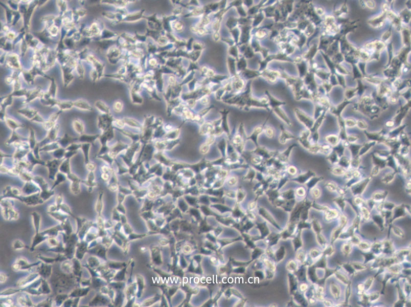 D283 Med (人腦髓母細(xì)胞瘤細(xì)胞) (STR鑒定正確)