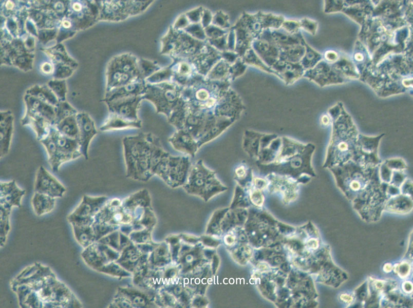 NCI-H1395 (人肺腺癌細胞) (STR鑒定正確)