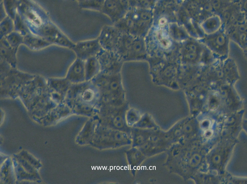 NCI-H1395 (人肺腺癌細(xì)胞) (STR鑒定正確)