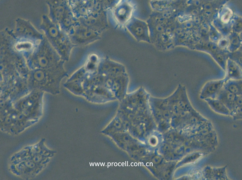 NCI-H1395 (人肺腺癌細(xì)胞) (STR鑒定正確)