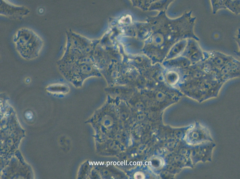 NCI-H1395 (人肺腺癌細(xì)胞) (STR鑒定正確)