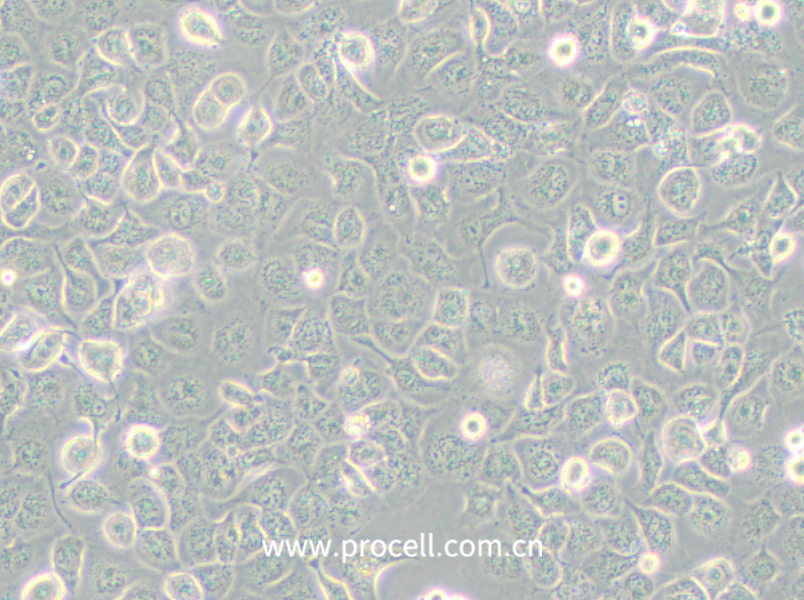 NCI-H661 (人大細(xì)胞肺癌細(xì)胞) (STR鑒定正確)