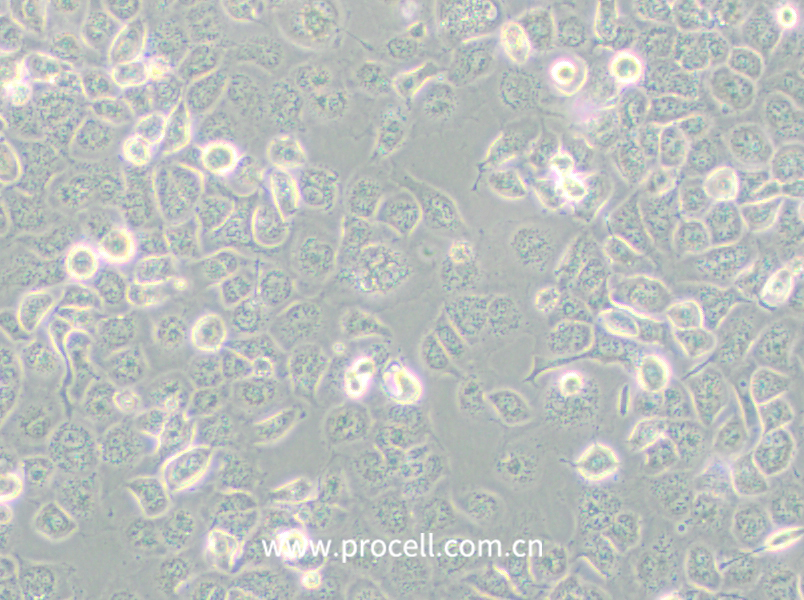 NCI-H661 (人大細(xì)胞肺癌細(xì)胞) (STR鑒定正確)