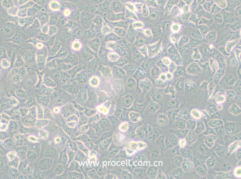 NCI-H661 (人大細(xì)胞肺癌細(xì)胞) (STR鑒定正確)