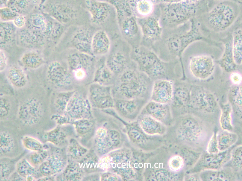 NCI-H661 (人大細(xì)胞肺癌細(xì)胞) (STR鑒定正確)