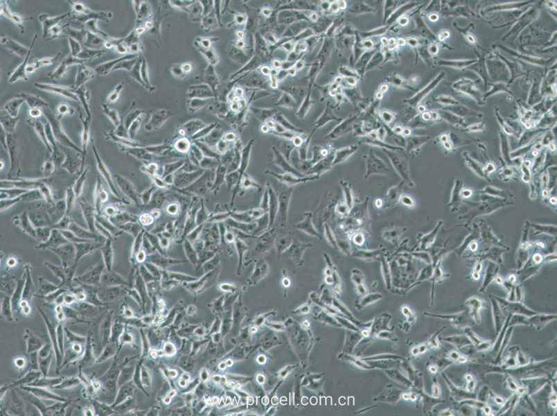 SF-295 (人XG惡性膠質(zhì)瘤細(xì)胞) (STR鑒定正確)