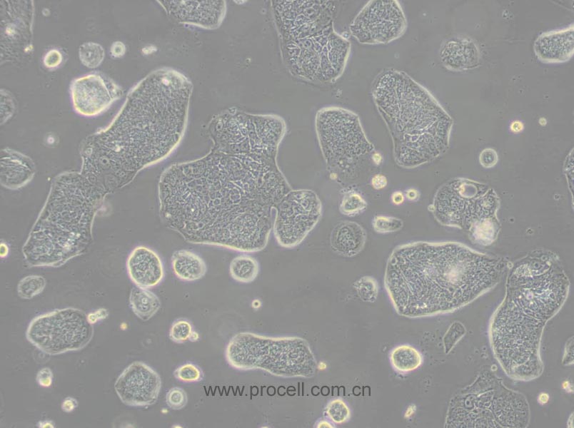 SW1116 (人結(jié)腸腺癌細(xì)胞) (STR鑒定正確)