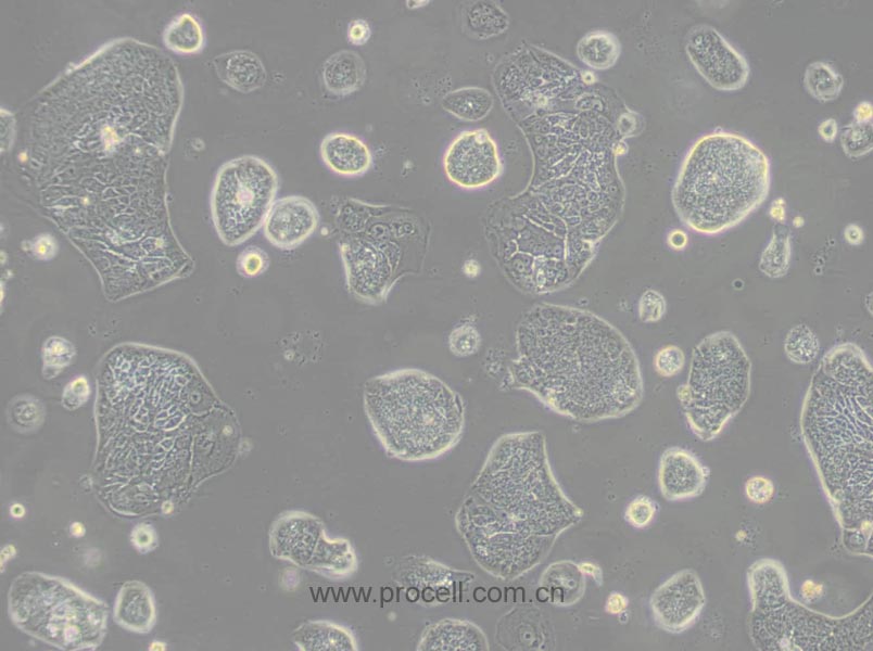 SW1116 (人結(jié)腸腺癌細(xì)胞) (STR鑒定正確)