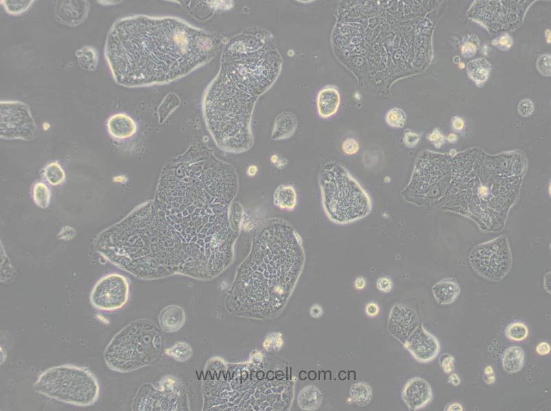 SW1116 (人結(jié)腸腺癌細(xì)胞) (STR鑒定正確)