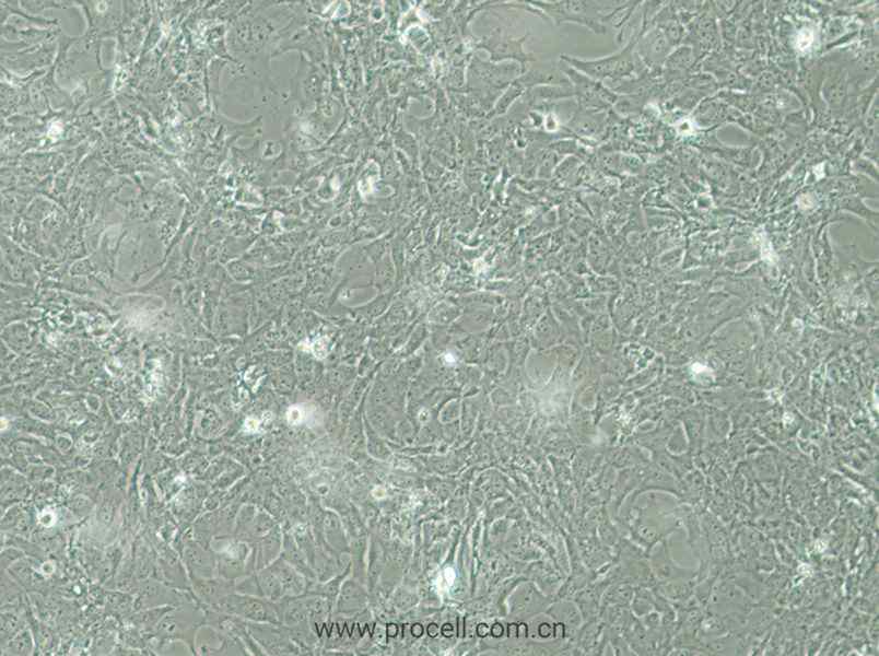 HCC38 (人乳腺導(dǎo)管癌細(xì)胞) (STR鑒定正確)