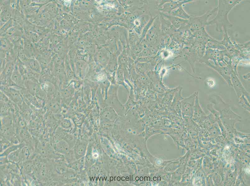 HCC38 (人乳腺導(dǎo)管癌細(xì)胞) (STR鑒定正確)