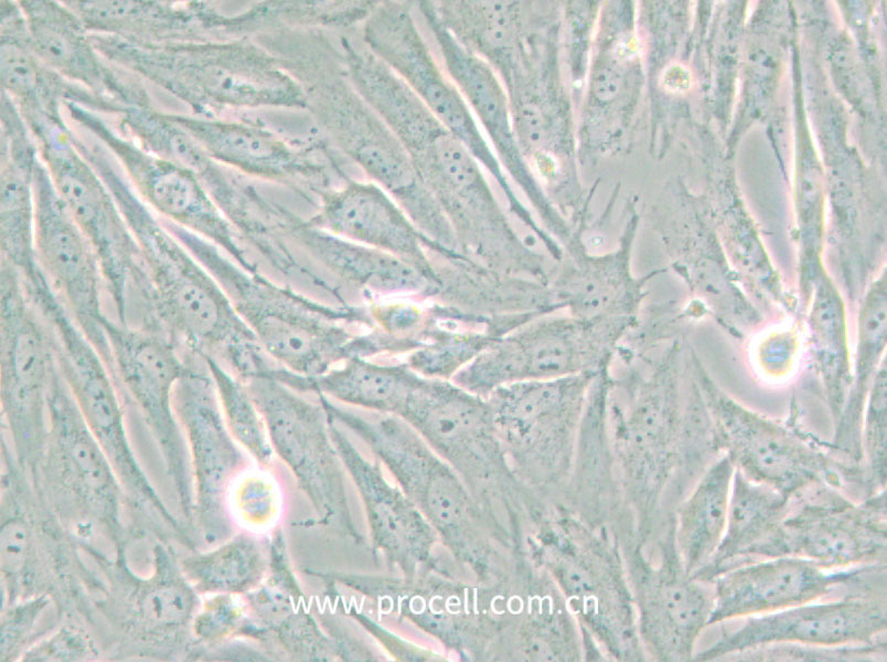 HS 683 (人腦膠質(zhì)瘤細(xì)胞) (STR鑒定正確)