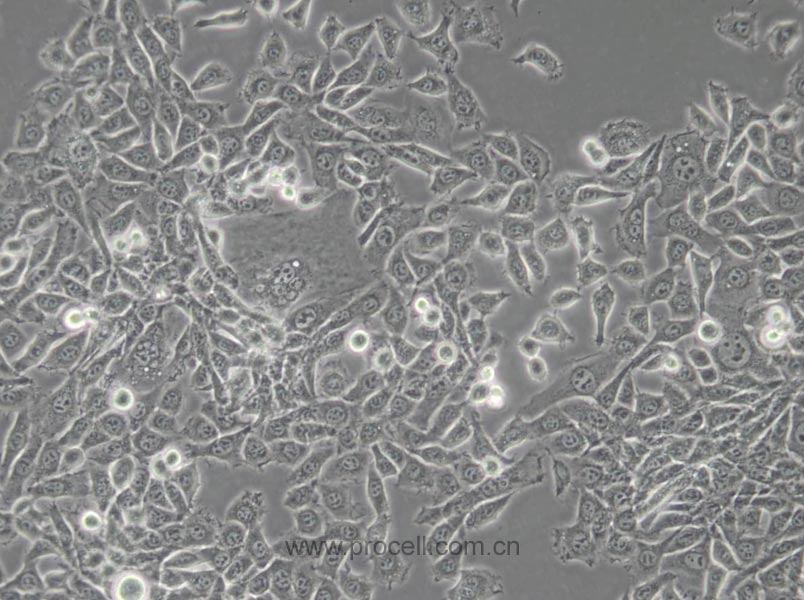 MDA-MB-415 (人乳腺癌細(xì)胞) (STR鑒定正確)