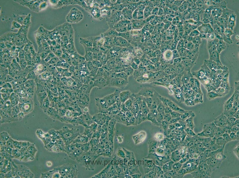 MS751 (人子宮頸表皮癌細(xì)胞) (STR鑒定正確)