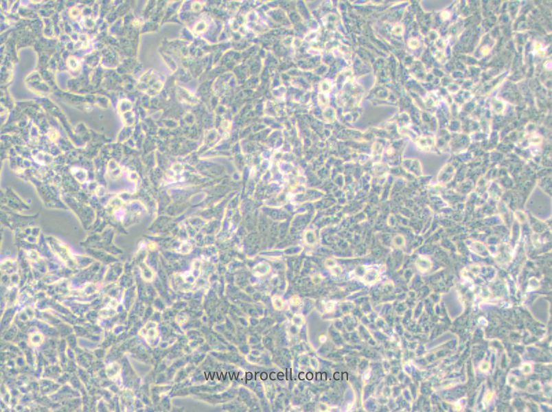 NCI-H295R (人腎上腺皮質(zhì)腺癌細(xì)胞) (STR鑒定正確)