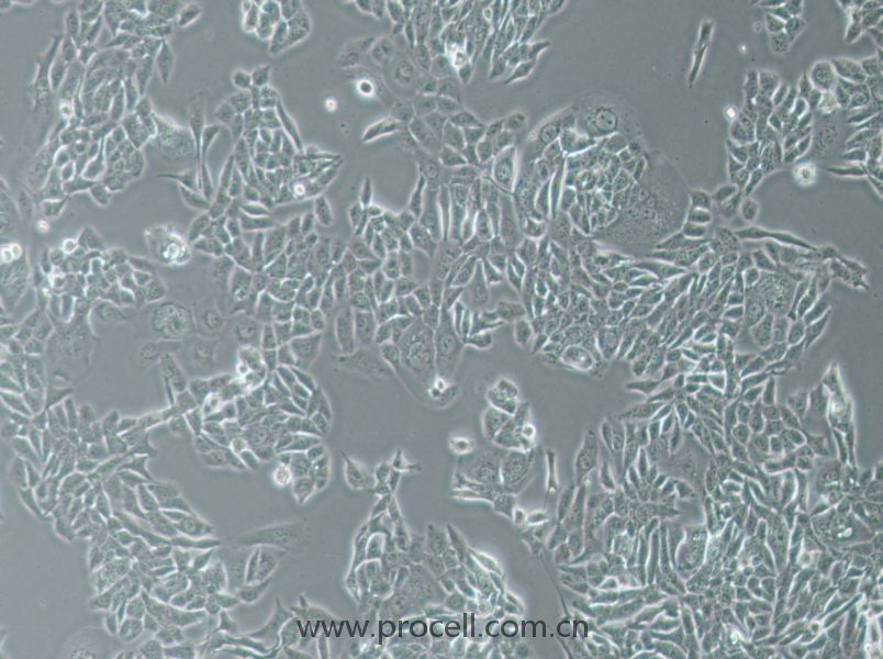 NCI-H358 (人非小細胞肺癌細胞) (STR鑒定正確)