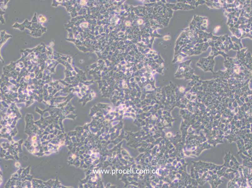 NCI-H520 (人肺鱗癌細(xì)胞) (STR鑒定正確)