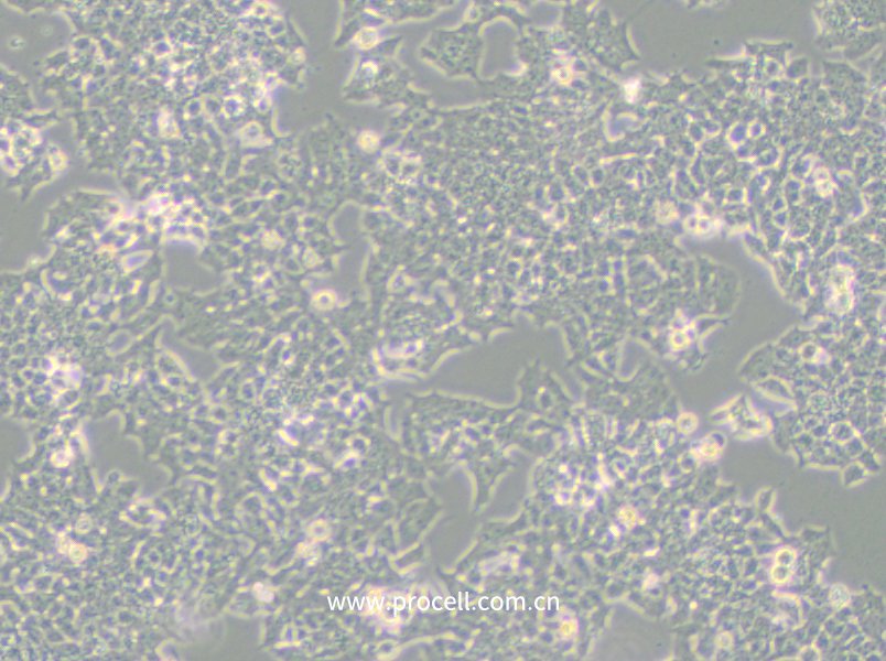 NCI-H520 (人肺鱗癌細(xì)胞) (STR鑒定正確)