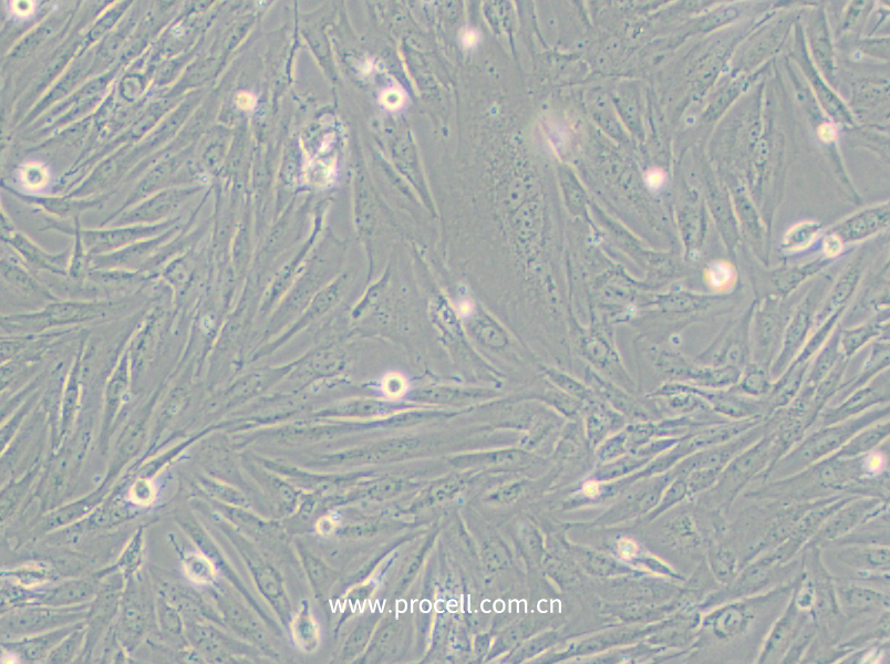 SF126 (人腦瘤細(xì)胞)(STR鑒定正確)