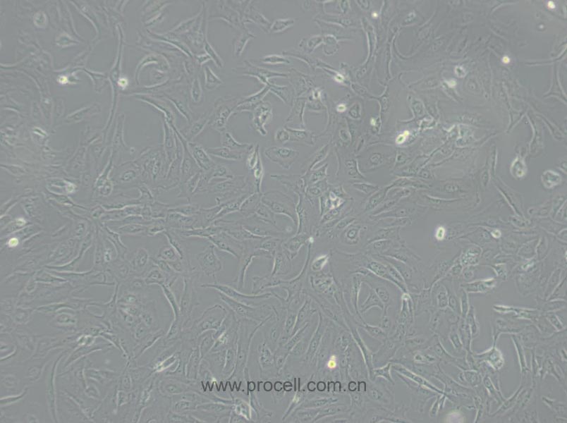 SW 1353 (人軟骨肉瘤細胞) (STR鑒定正確)