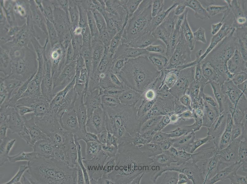 SW 1353 (人軟骨肉瘤細胞) (STR鑒定正確)