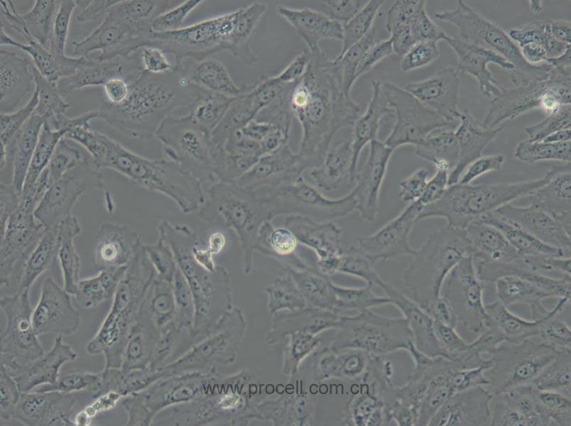 SW 1353 (人軟骨肉瘤細胞) (STR鑒定正確)